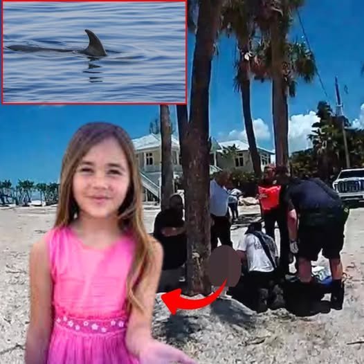 9-year-old girl nearly loses her hand in shark attack off Florida Gulf Coast